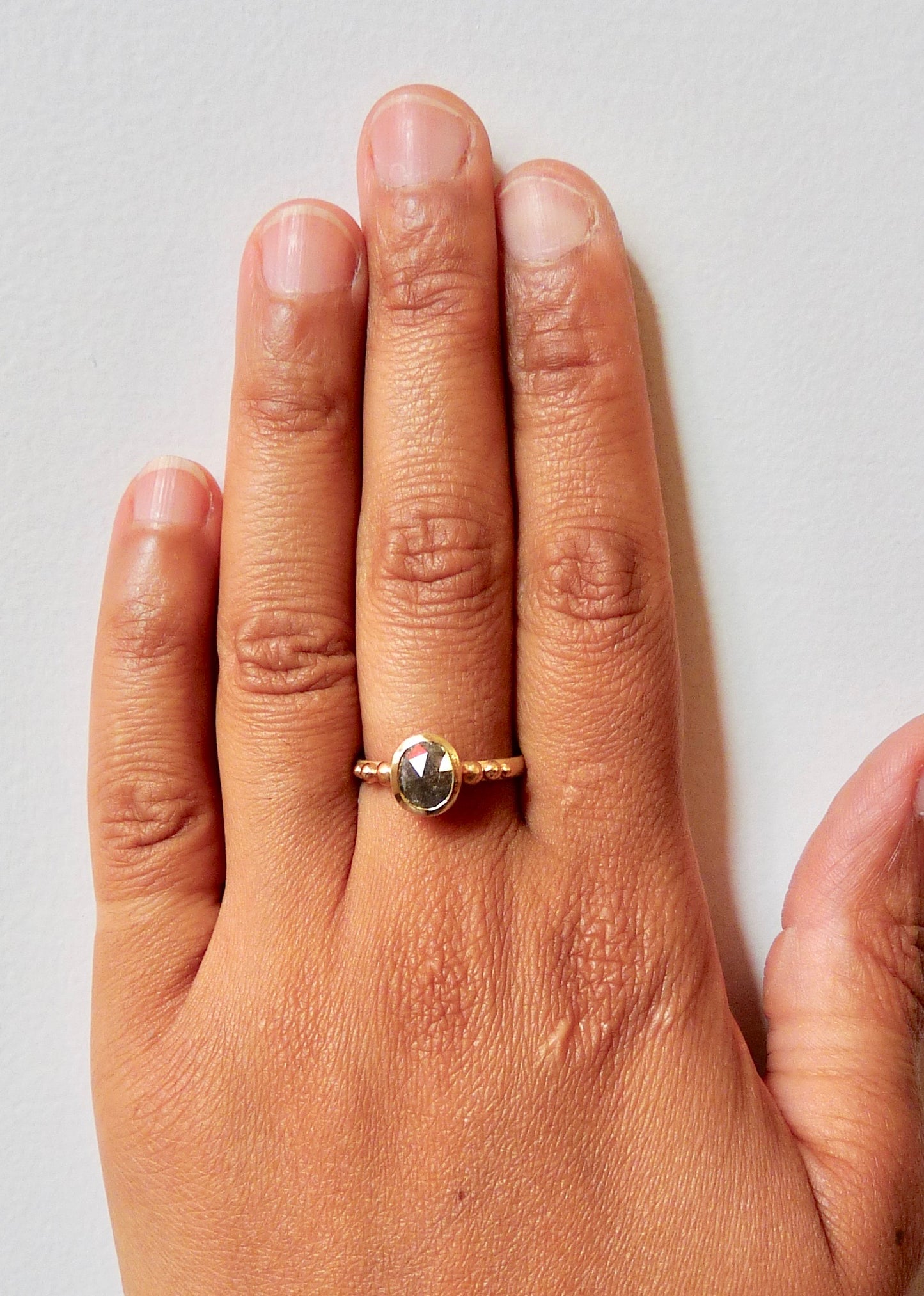 Salt And Pepper Granulation Ring